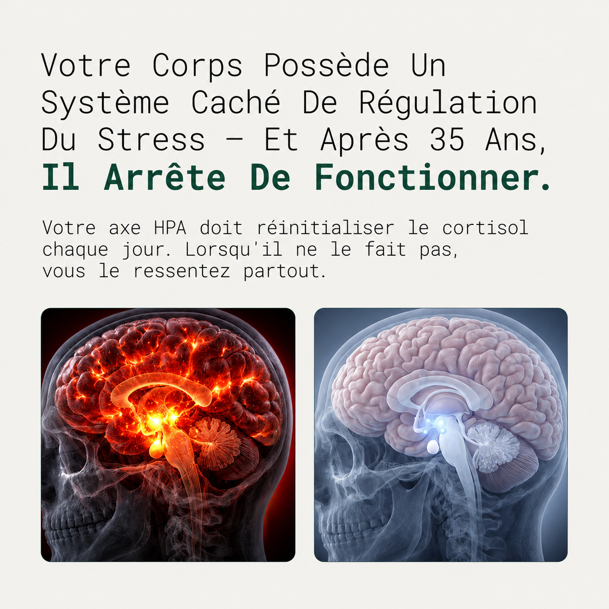 Vivance™ 2