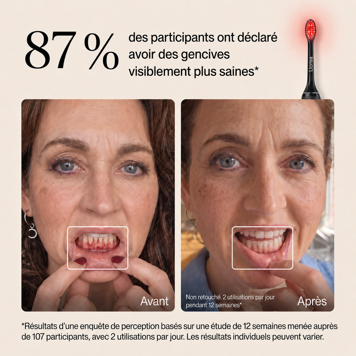 Brosse à dents Llorrea à lumière rouge + bleue